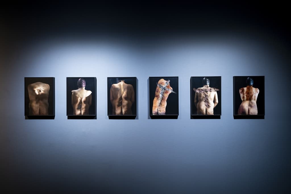 Photos of Vivan Sundaram’s back after three spinal surgeries, manipulated to make us feel the body’s vulnerability.